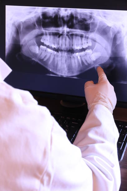Best Emergency Broken Tooth Repair in Monroe North, WA